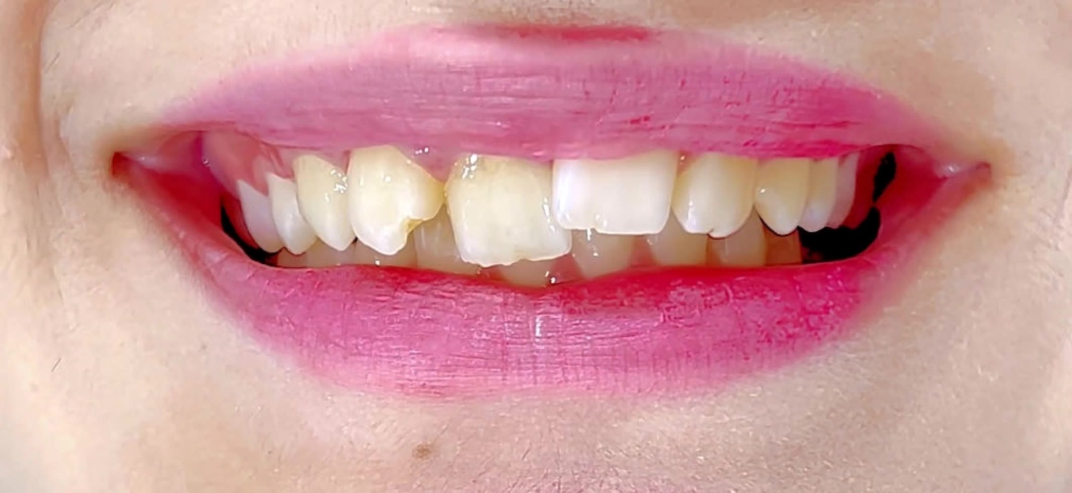 Kling AI work 312573650663569 - free put smile on photo AI video